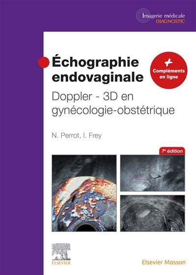 échographie endovaginale Doppler 3D : en gynécologie-obstétrique