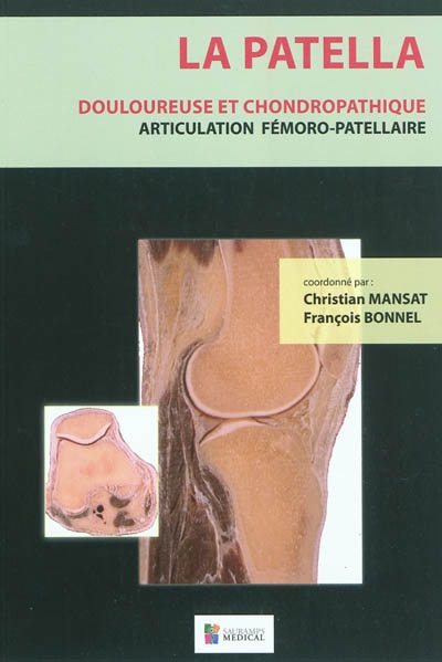 La patella : douloureuse et chondropathique : articulation fémoro-patellaire : anatomie, biomécanique, clinique, rééducation, chirurgie