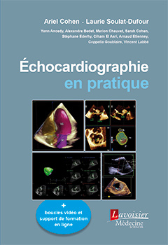 Échocardiographie en pratique
