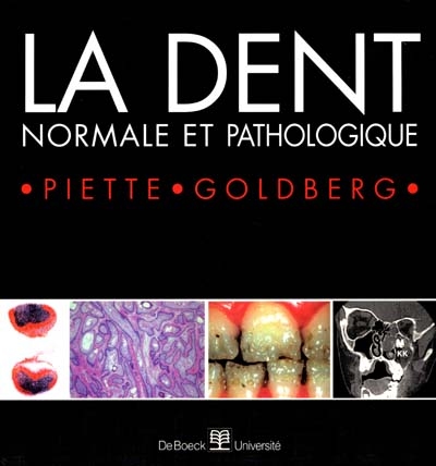 La dent : normale et pathologique