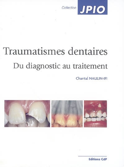Traumatismes dentaires : du diagnostic au traitement