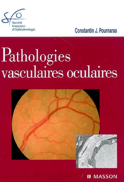 Pathologies vasculaires oculaires : [rapport présenté à la] Société française d'ophtalmologie