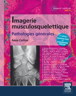 Imagerie musculosquelettique : pathologies générales