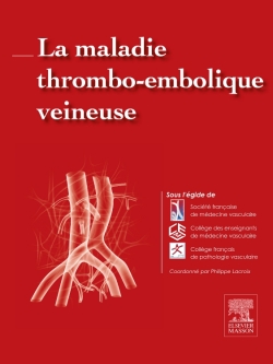 La maladie thrombo-embolique veineuse