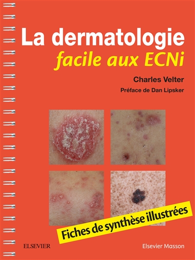 La dermatologie facile aux ECNi : fiches de synthèse illustrées