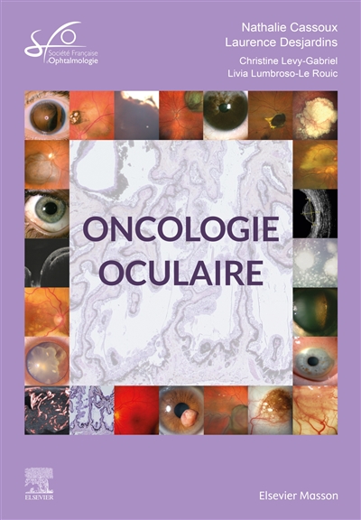 Oncologie oculaire : rapport 2022