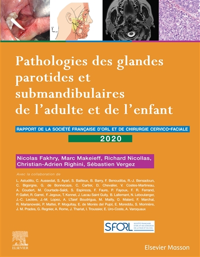 Pathologies des glandes parotides et submandibulaires de l'adulte et de l'enfant : rapport 2020 de la Société française d'ORL et de chirurgie cervico-faciale