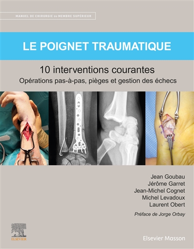 Le poignet traumatique : 10 interventions courantes : manuel de chirurgie du membre supérieur