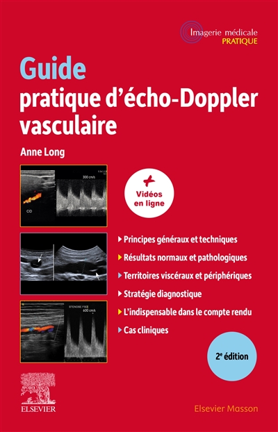 Guide pratique d'écho-Doppler vasculaire