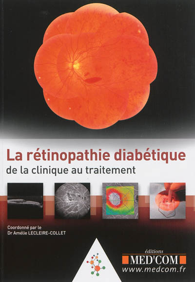 La rétinopathie diabétique : de la clinique au traitement