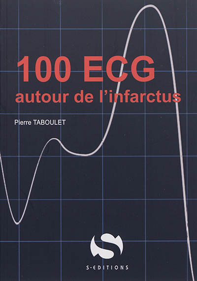 100 ECG autour de l'infarctus