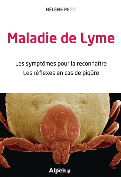 Maladie de Lyme : les symptômes pour la reconnaître, les réflexes en cas de piqûre