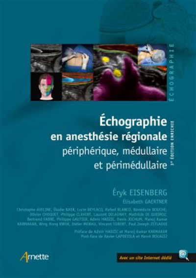 Échographie en anesthésie régionale périphérique, médullaire et périmédullaire