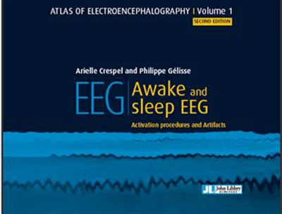 Awake and sleep EEG : activation procedures and artifacts