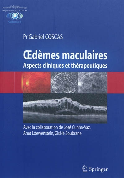 Oedèmes maculaires : aspects cliniques et thérapeutiques