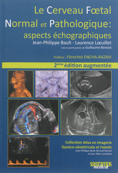 Le cerveau foetal normal et pathologique : aspects échographiques