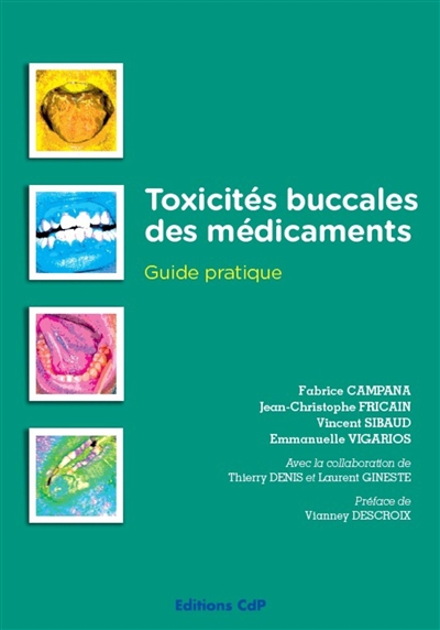 Toxicités buccales des médicaments : guide pratique