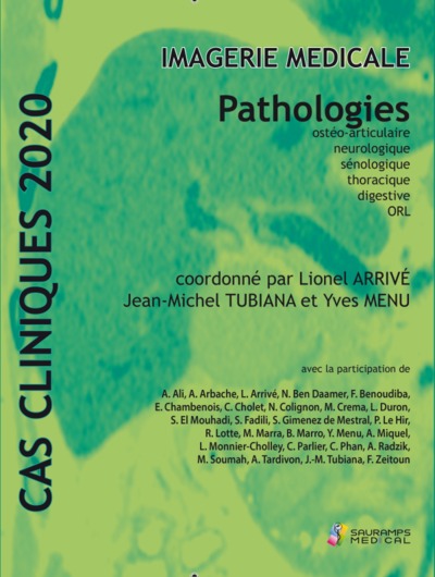 Imagerie médicale : pathologies ostéo-articulaire, neurologique, sénologique, thoracique, digestive, ORL : cas cliniques 2020