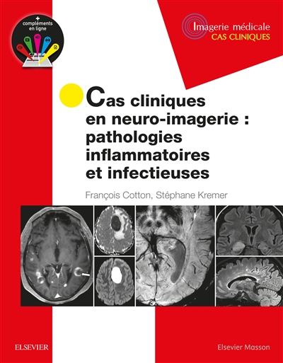 Cas cliniques en neuro-imagerie : pathologies inflammatoires et infectueuses