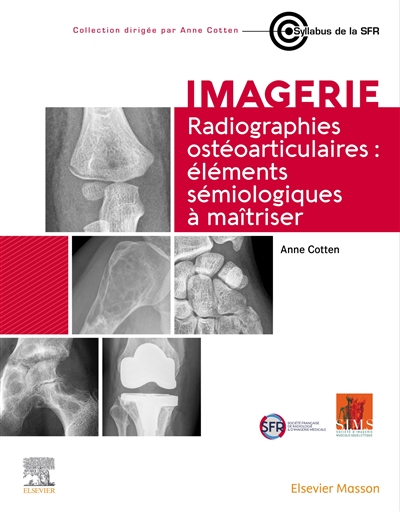 Radiographies ostéoarticulaires : éléments sémiologiques à maîtriser