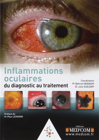 Inflammations oculaires : du diagnostic au traitement