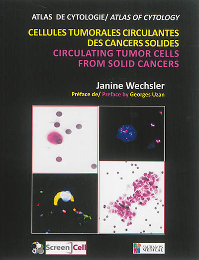 Cellules tumorales circulantes, CTC, des cancers solides