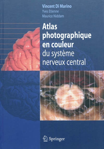 Atlas photographique en couleur du système nerveux central : contient 350 photographies en couleur