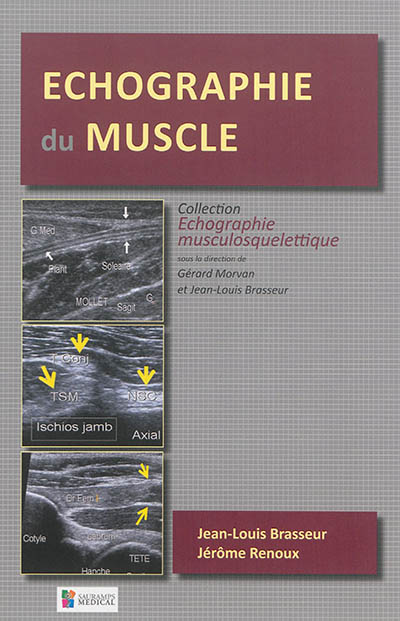 Échographie du muscle