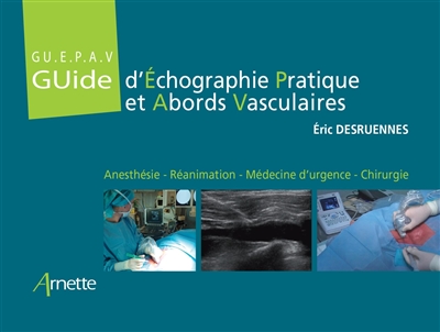 Guide d'échographie pratique et abords vasculaires : GU.E.P.A.V