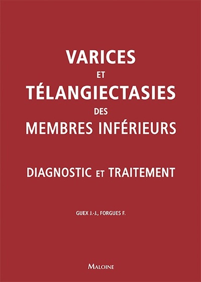 Varices et télangiectasies des membres inférieurs : diagnostic et traitement