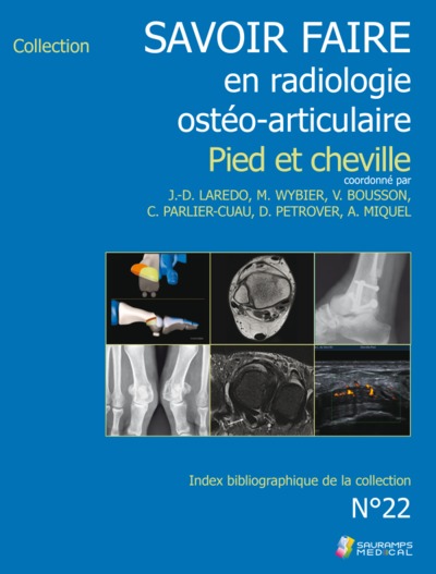 Savoir faire en radiologie ostéo-articulaire : pied et cheville : n°22, 2020