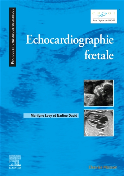 échocardiographie fœtale