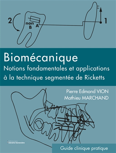 Biomécanique : notions fondamentales et applications à la technique segmentée de Ricketts