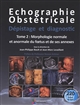 Échographie obstétricale : dépistage et diagnostic. Tome 2 , Morphologie normale et anormale du foetus et de ses annexes